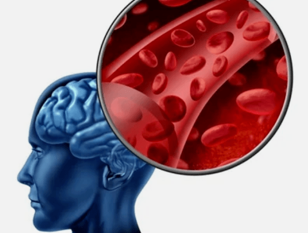 Osteocondrosi del collo