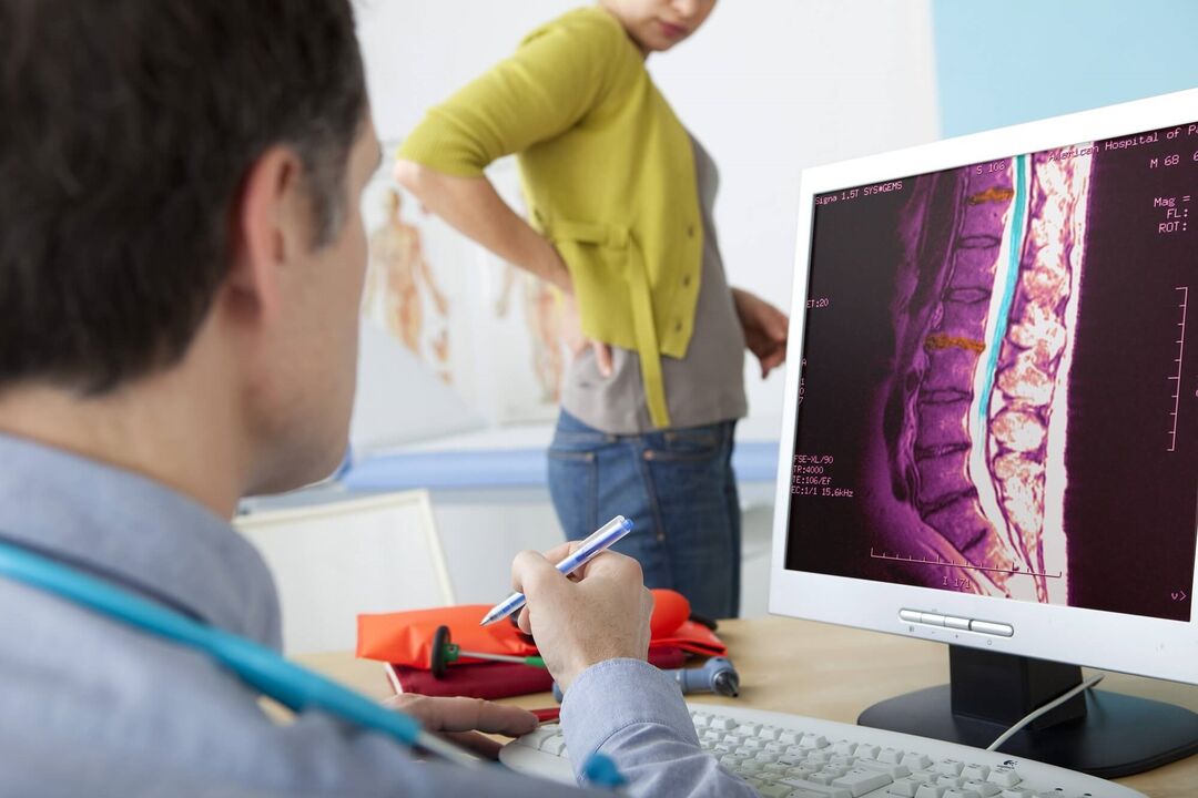 Diagnosi di osteocondosi lombare