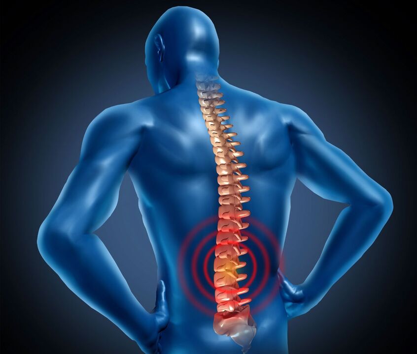 Osteocondrosi lombare