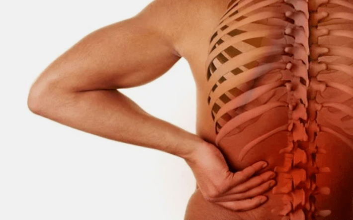 Le cause dell'osteocondosi del lombare