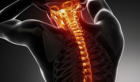 Osteocondrosi dell'intera colonna vertebrale
