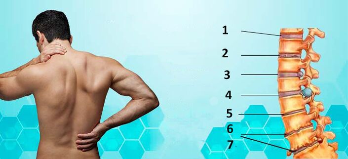 fasi di sviluppo dell'osteocondrosi